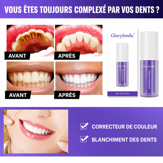 Le Blanchiment Dentaire (Glorysmile)